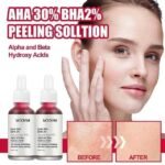 Mooyam AHA 30% BHA 2% Alpha and Beta Hydroxy Acids 10- Minute Exfoliting Solution Deep Peeling 30ml